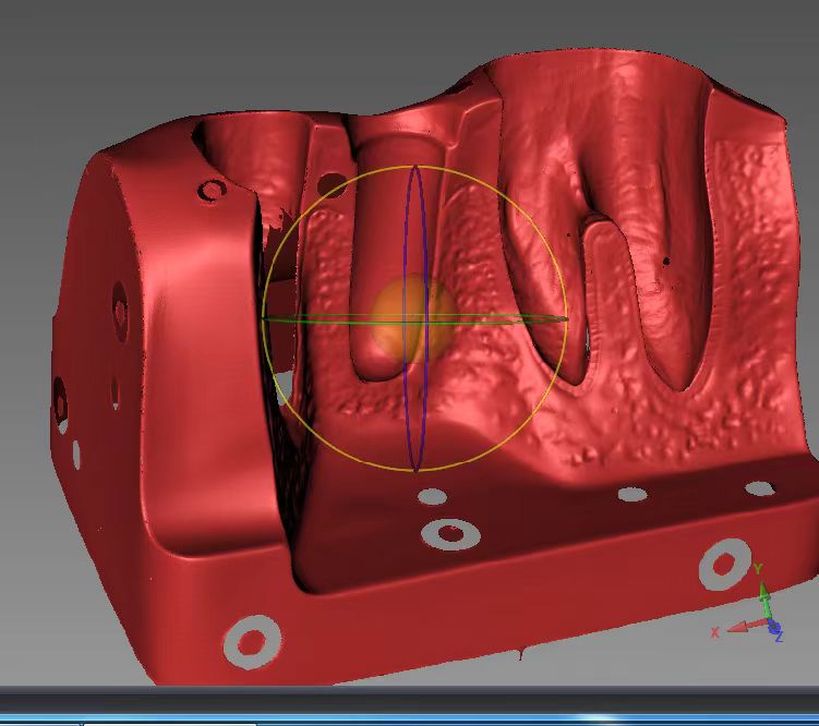 牙科用品抄數(shù)